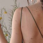 Manchas na pele: o que são, tipos e causa - Blog - Tópicos Gerais - Uma Vida Mais Abundante